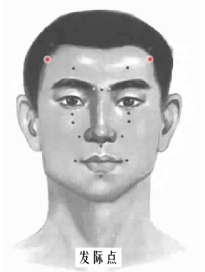 发际穴
