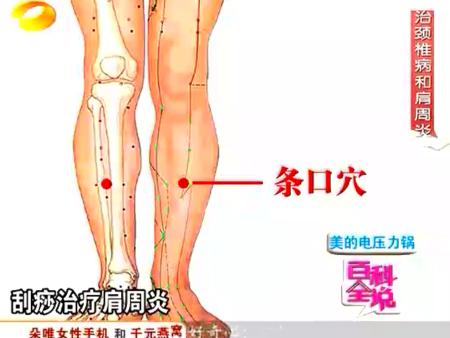 条口穴