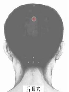 后顶穴