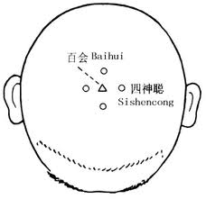 四神聪穴